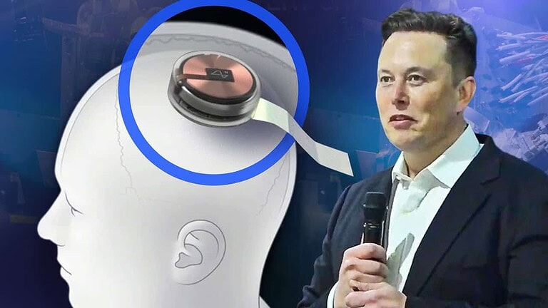 Elon Musk's Neuralink