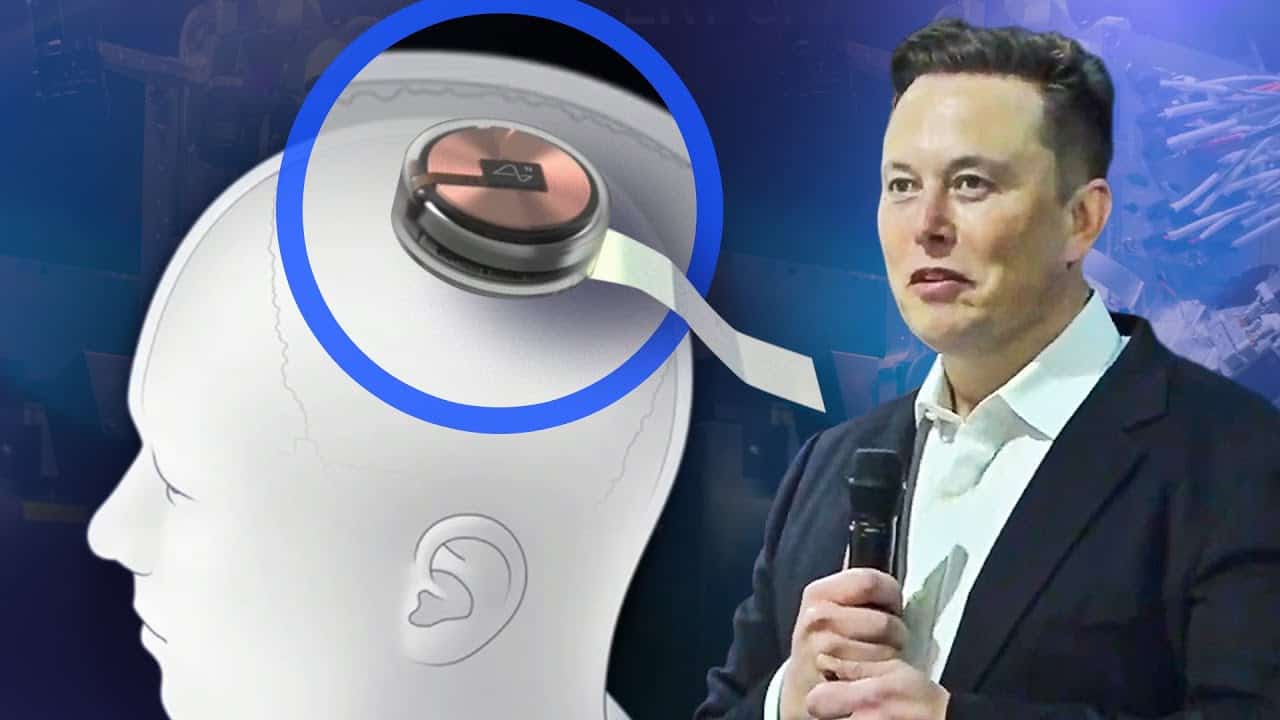 Elon Musk's Neuralink