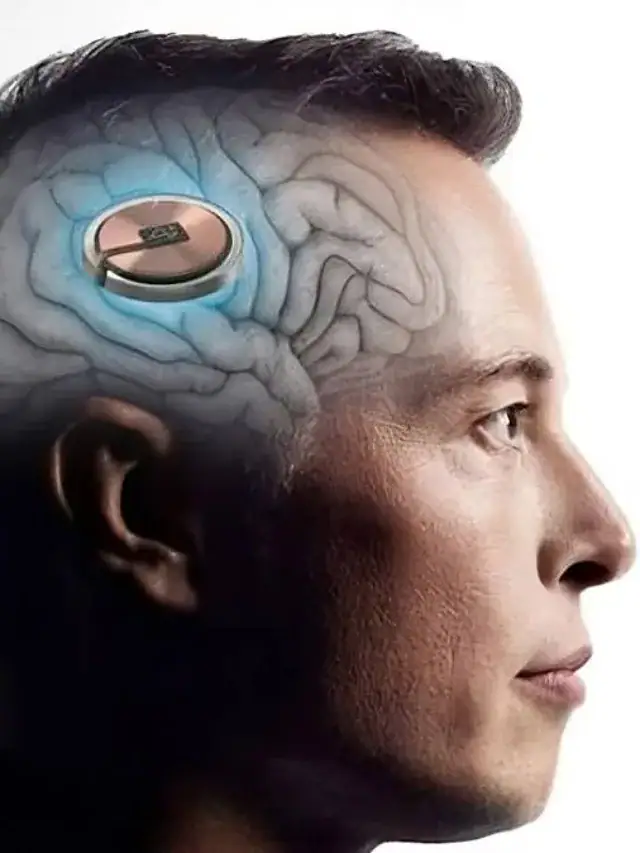 Neuralink Implant